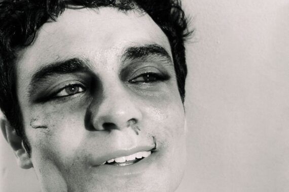 Del Water Gap 'I Miss You Already + I Haven't Left Yet (Deluxe)' album art